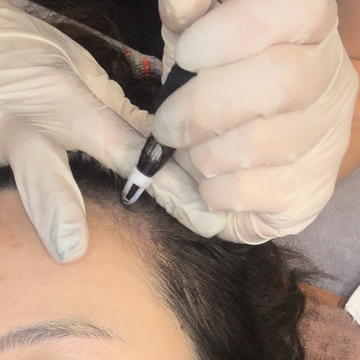 MEOD Aesthetic - Hair Growth Solutions (Scalp Micro-Pigmentation, SMP, Micro-Needling Hair Growth)