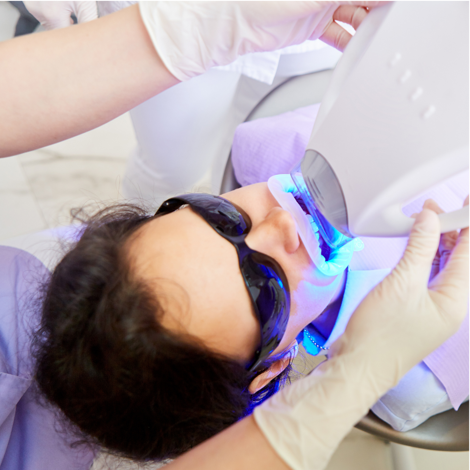 MEOD Beauty & Aesthetics - LED Teeth Whitening